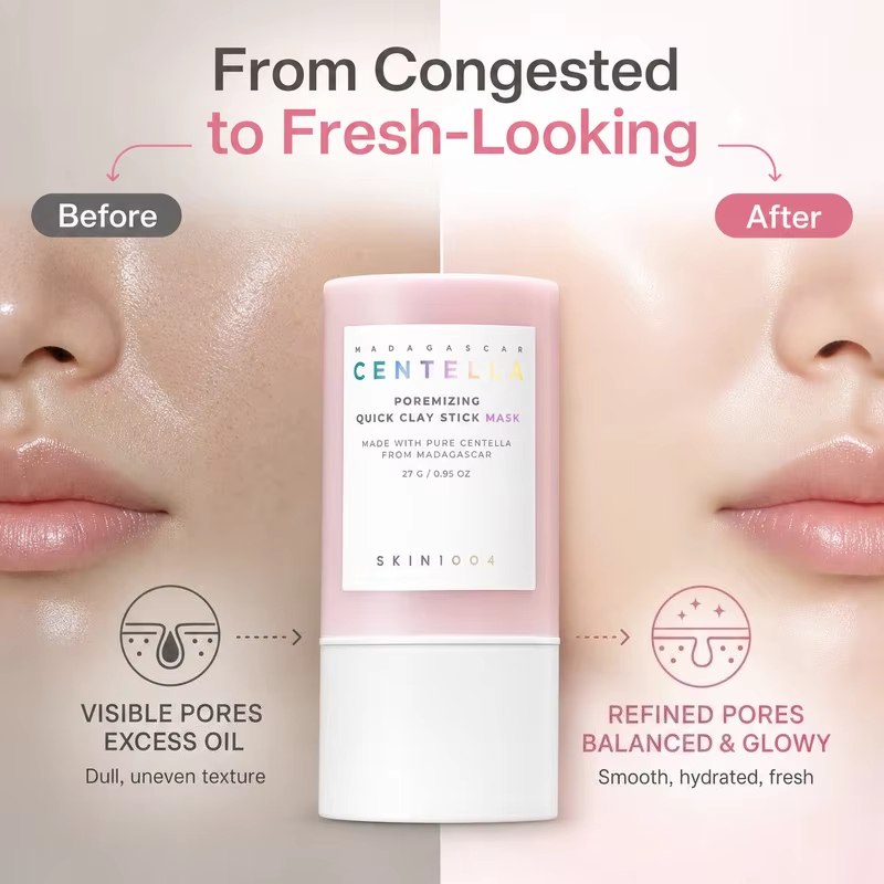 SKIN1004 Koreaans Centella Por - Dust Mask Construction recensie en prijs